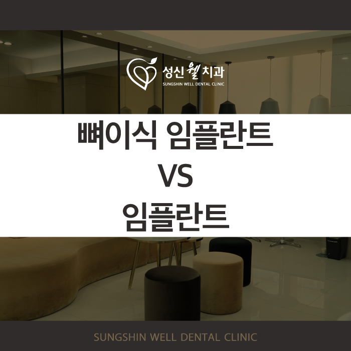 성신여대치과 임플란트 뼈이식이 걱정되셨다면 읽어보세요