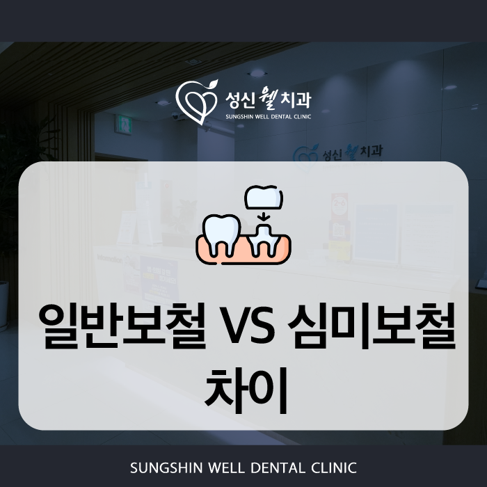 성신여대치과 보철치료 선택 전 알아야 할 점들