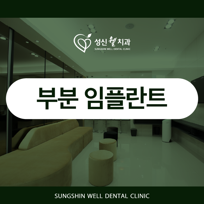 성신여대치과 부분 임플란트, 꼭 해야 할까? 놓치기 쉬운 진실